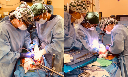 Xenotransplantation-surgery 2