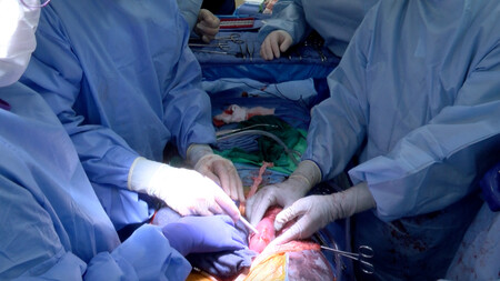 -xenotransplantation-surgery