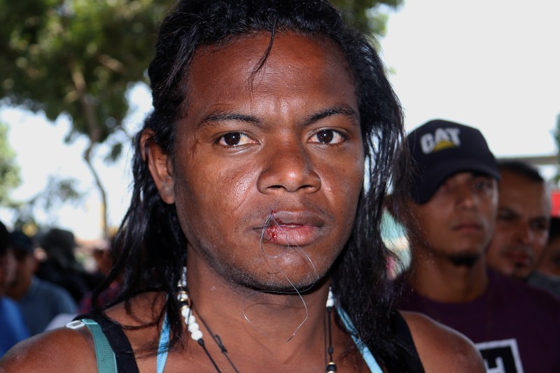 Migrantes en caravana se cosen los labios para presionar al INM - migrantes-se-cosen-los-labios-1024x683