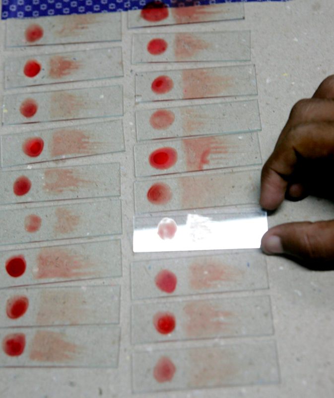 Estados Unidos en alerta ante varios casos de transmisión local de malaria - malaria-861x1024