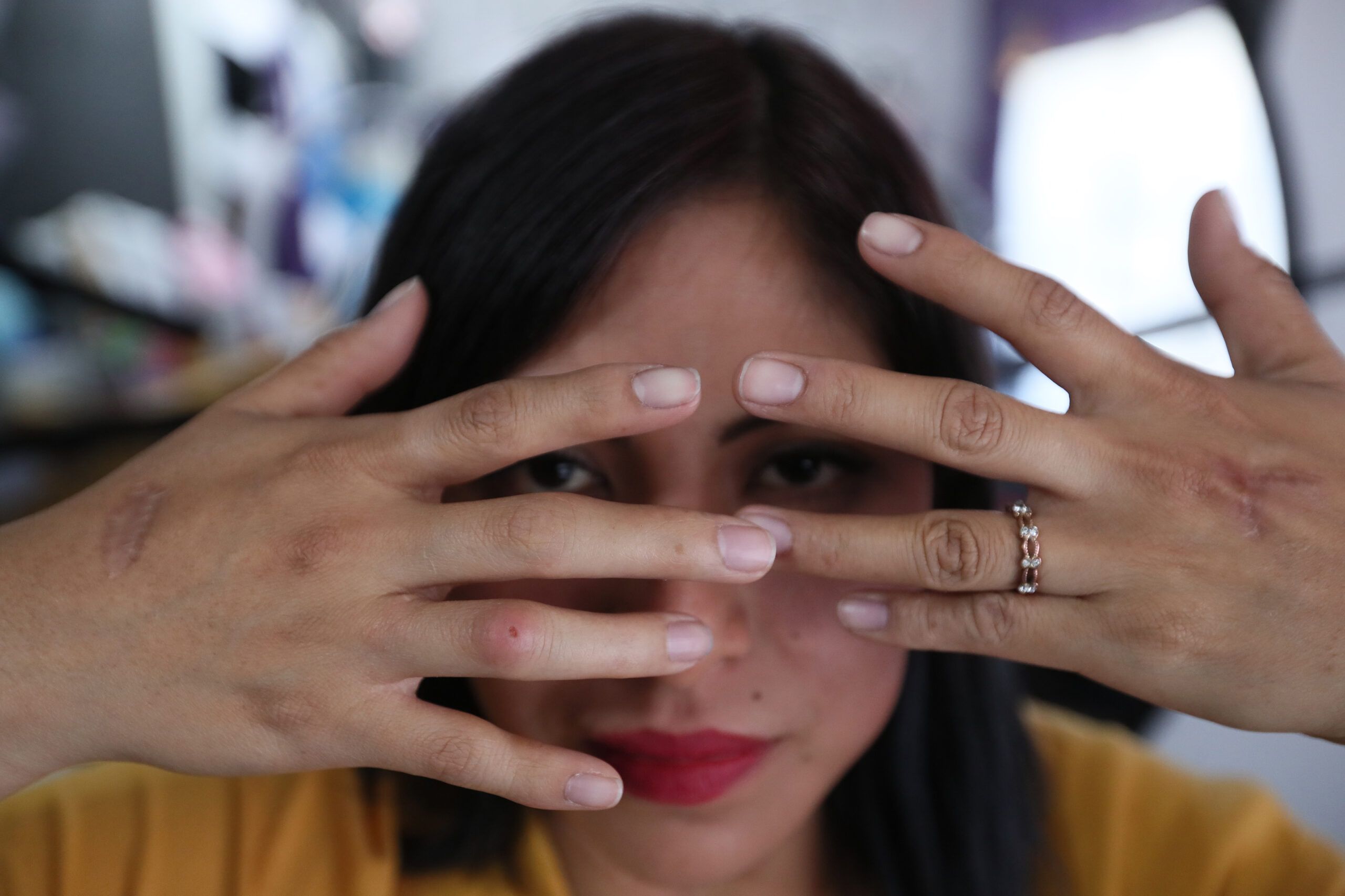 “Vivir sin miedo”, el reto de una víctima de intento de feminicidio en México “Vivir sin miedo”, el reto de una víctima de intento de feminicidio en México